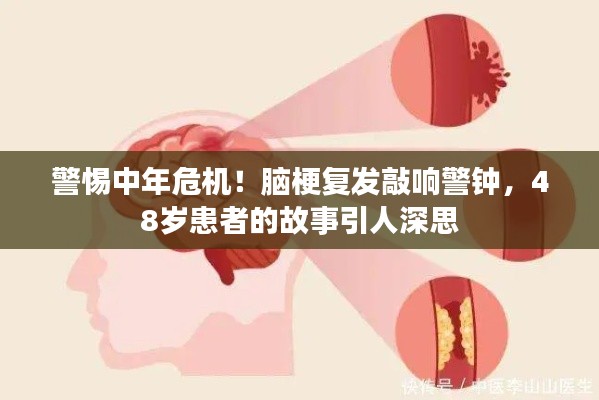 警惕中年危機！腦梗復發敲響警鐘，48歲患者的故事引人深思